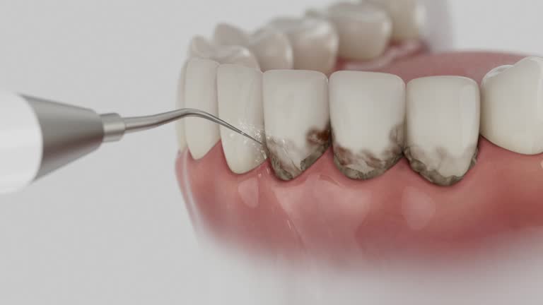 Reliable Dental contractor in Tunnel Hill, GA by Dentist Open Now